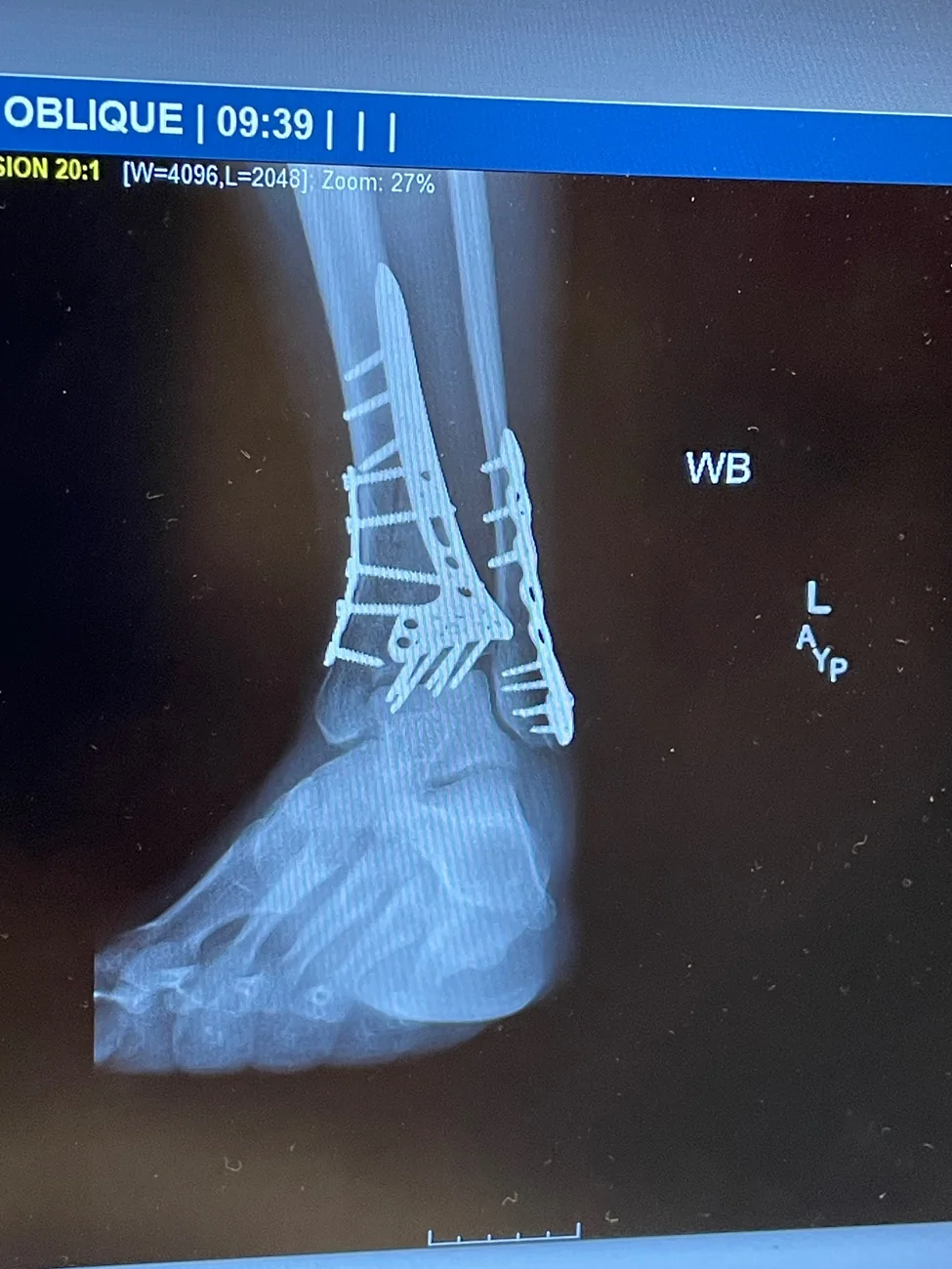 2024 Tacoma Tacomas and Mountain Bikes IMG_2998